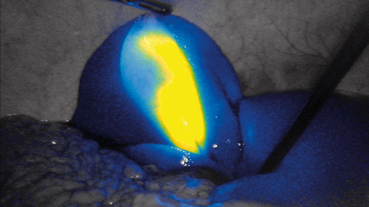 Intensità FI - Tecnologia di imaging a fluorescenza 3D